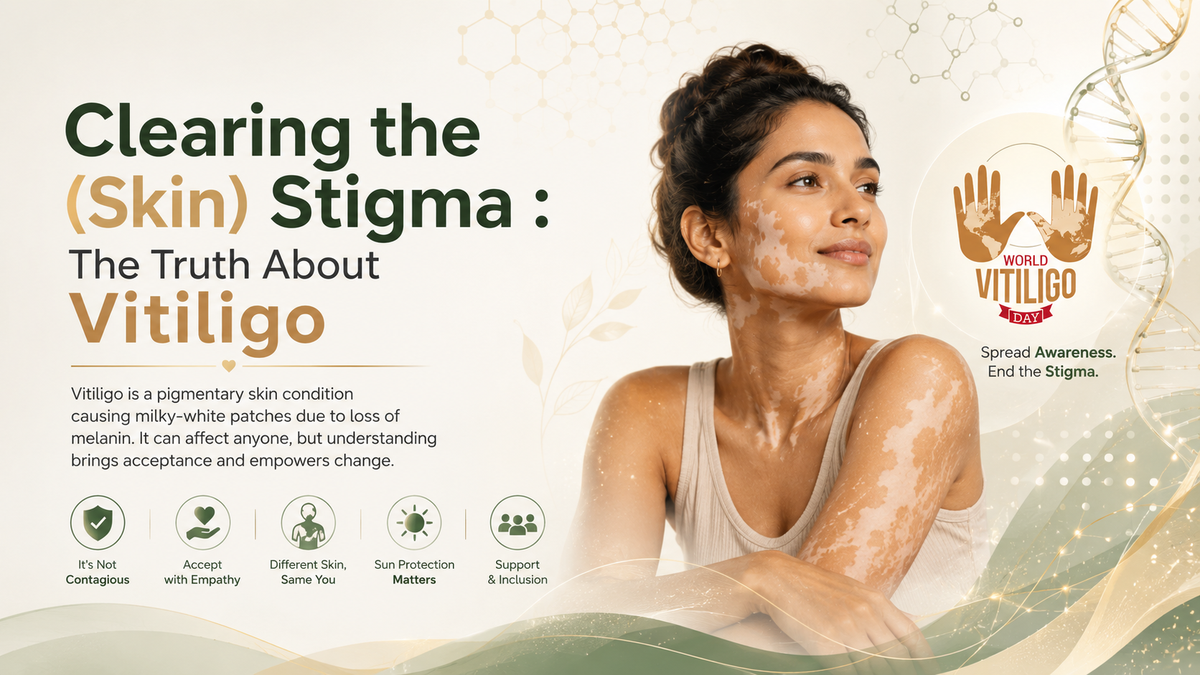 Clearing the stigma: understanding vitiligo